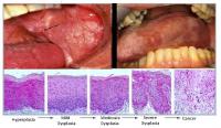 Oral & Maxillofacial Pathology - Pathology and Cell Biology